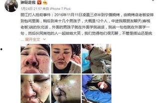 爆料博主毁容事件真相视频,爆料博主遭遇的惊人内幕  第1张